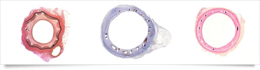 Plateforme d'histologie appliquée aux maladies vasculaires