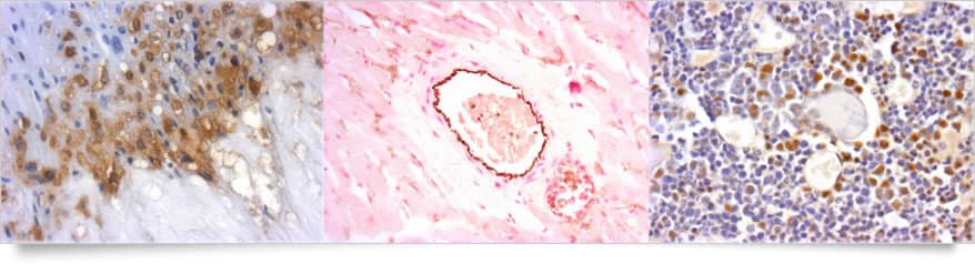 Immunohistochimie standardisée et optimisée