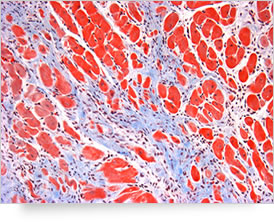 Trichrome de Masson